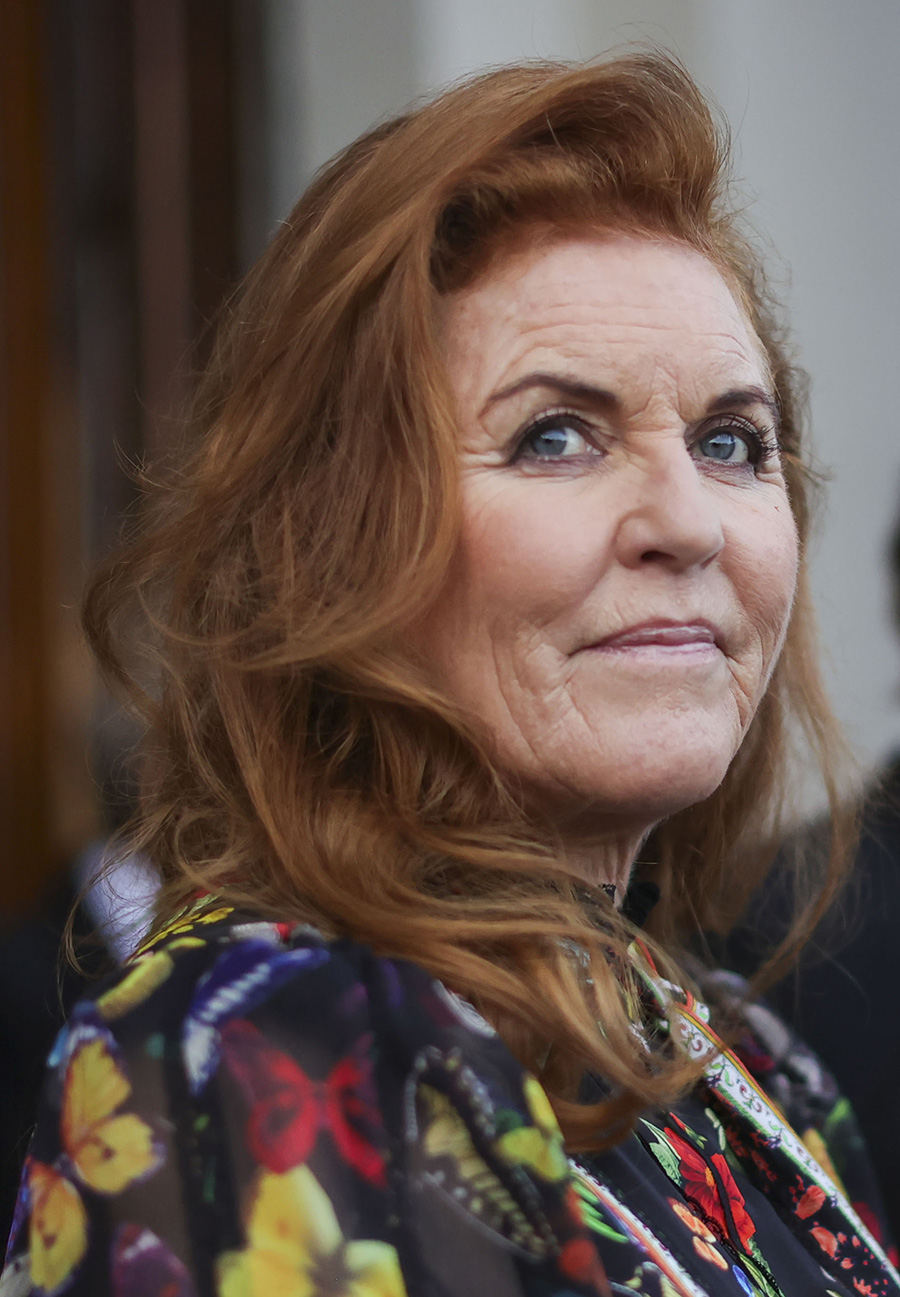 nya beskedet om fergies fruktansvärda sjukdom 1 Nya beskedet om Fergies fruktansvärda sjukdom