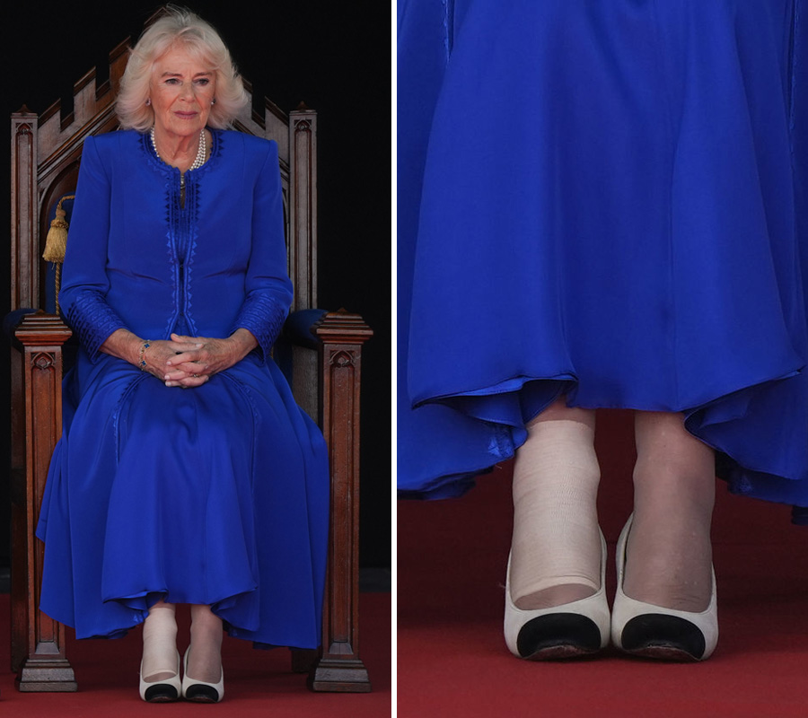drottning camilla skadad efter olycka på resa – läkare på plats 3 Drottning Camilla skadad efter olycka på resa – läkare på plats